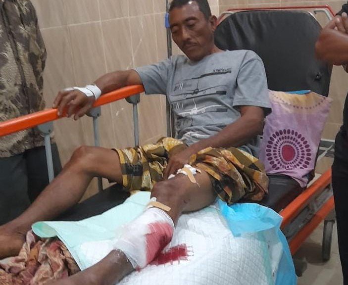  Baharuddin, 50, korban terkaman buaya, warga Desa Rantau Gedang, Kecamatan Singkil, Kabupaten Aceh Singkil, dalam perawatan di rumah sakit.