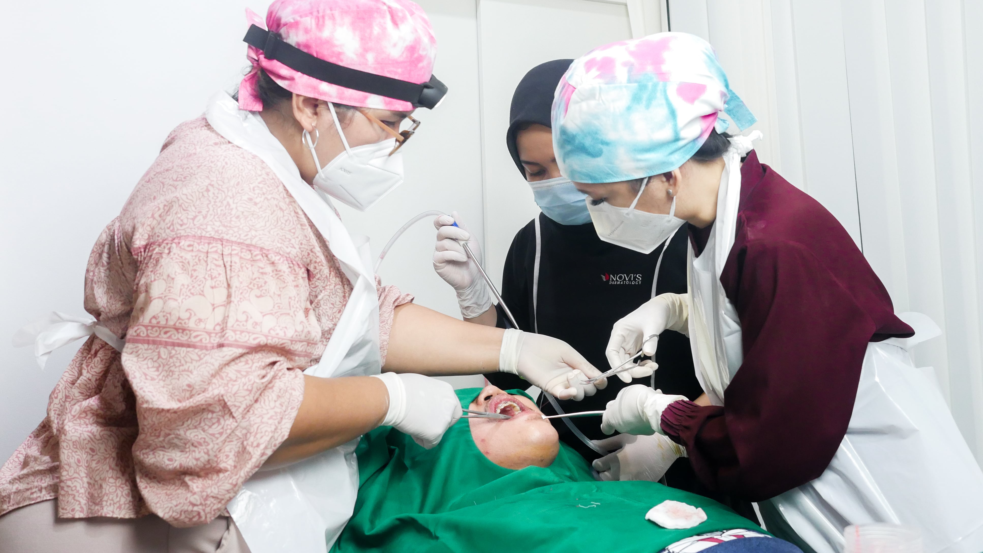 Ilustrasi perawatan wajah dengan metode buccal fat removal