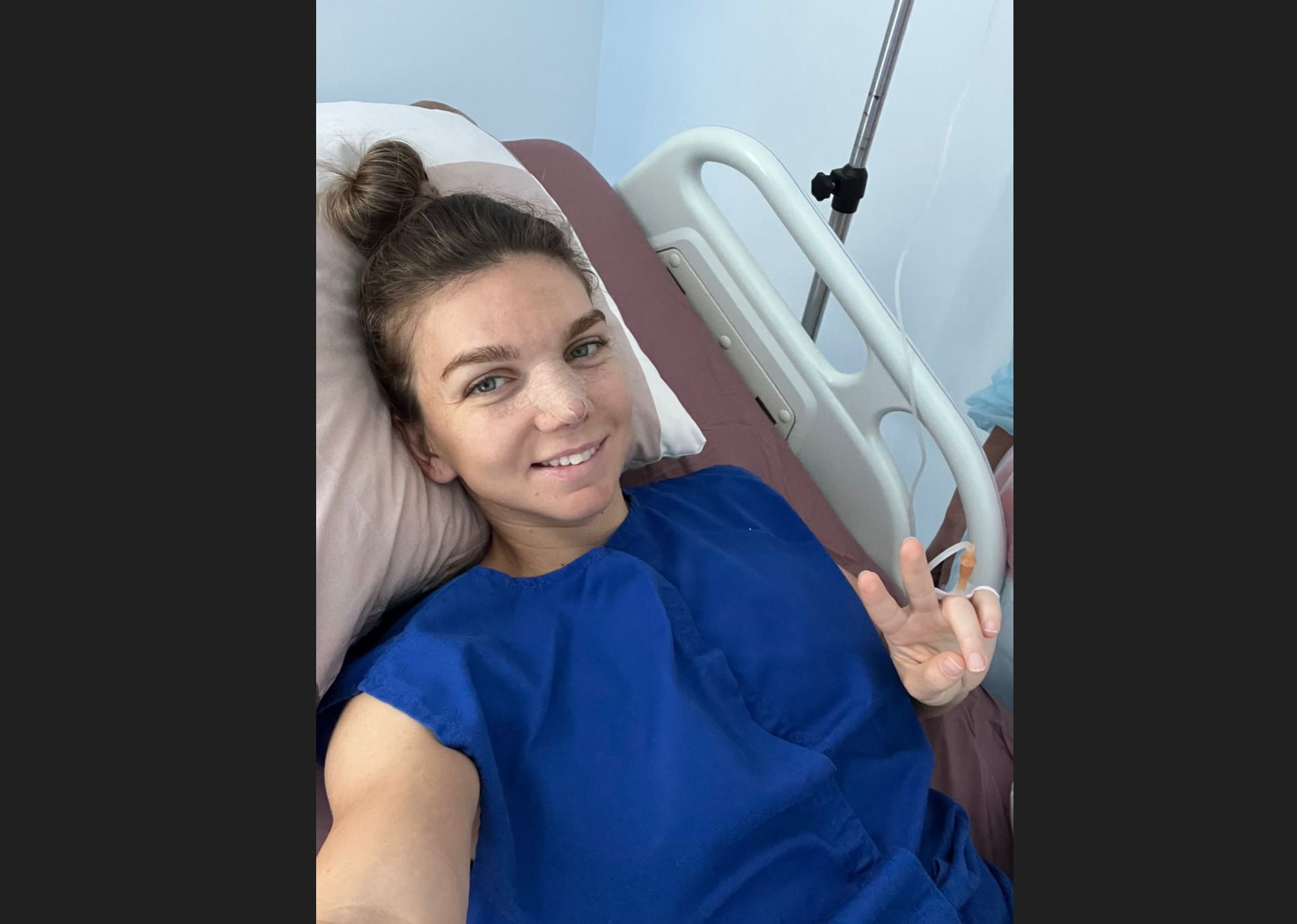 Simona Halep usai menjalani operasi hidung
