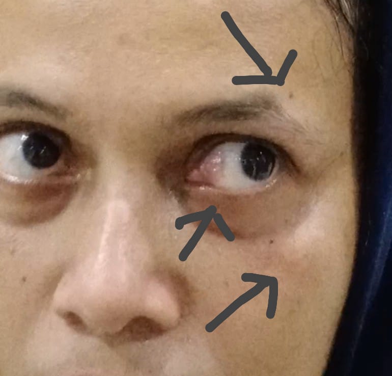 Polri, Saya Korban Kekerasan Mohon Perlindungan dan Keadilan 