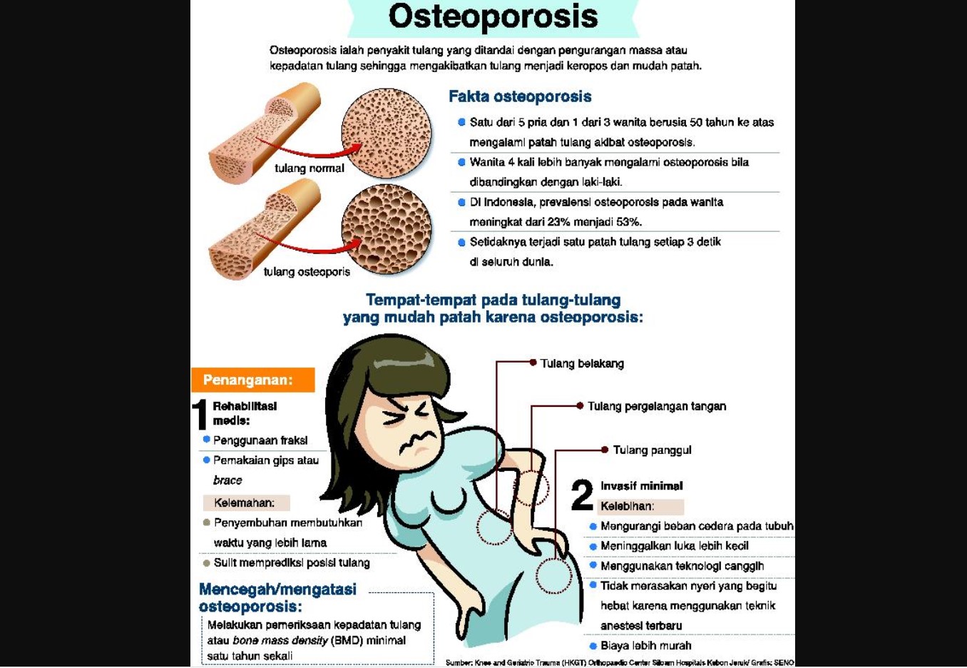 Cegah Osteoporosis dengan Menabung Tulang Sejak Dini