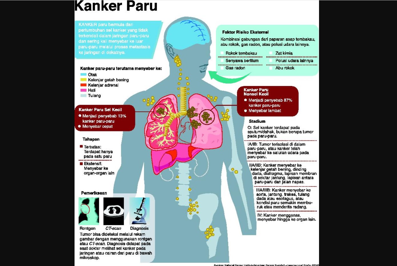 Infografis kanker paru