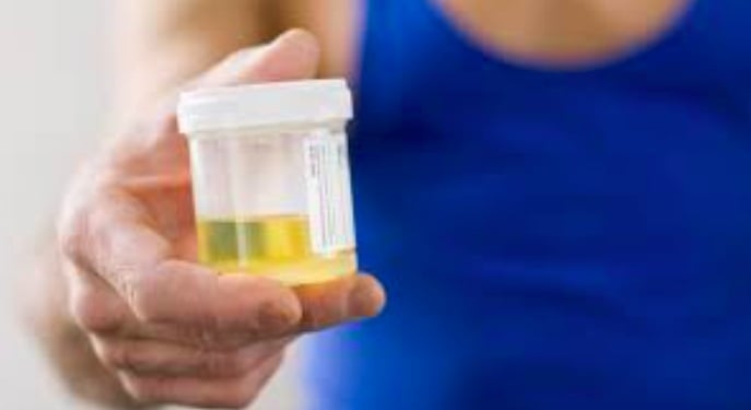 Ilustrasi. Tes urine untuk mengetahui apakah sesorang menggunakan narkoba atau tidak.