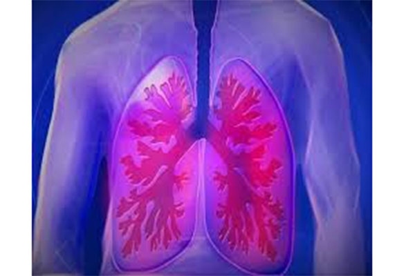 Yuk, Kenali Penyebab dan Gejala Pneumonia