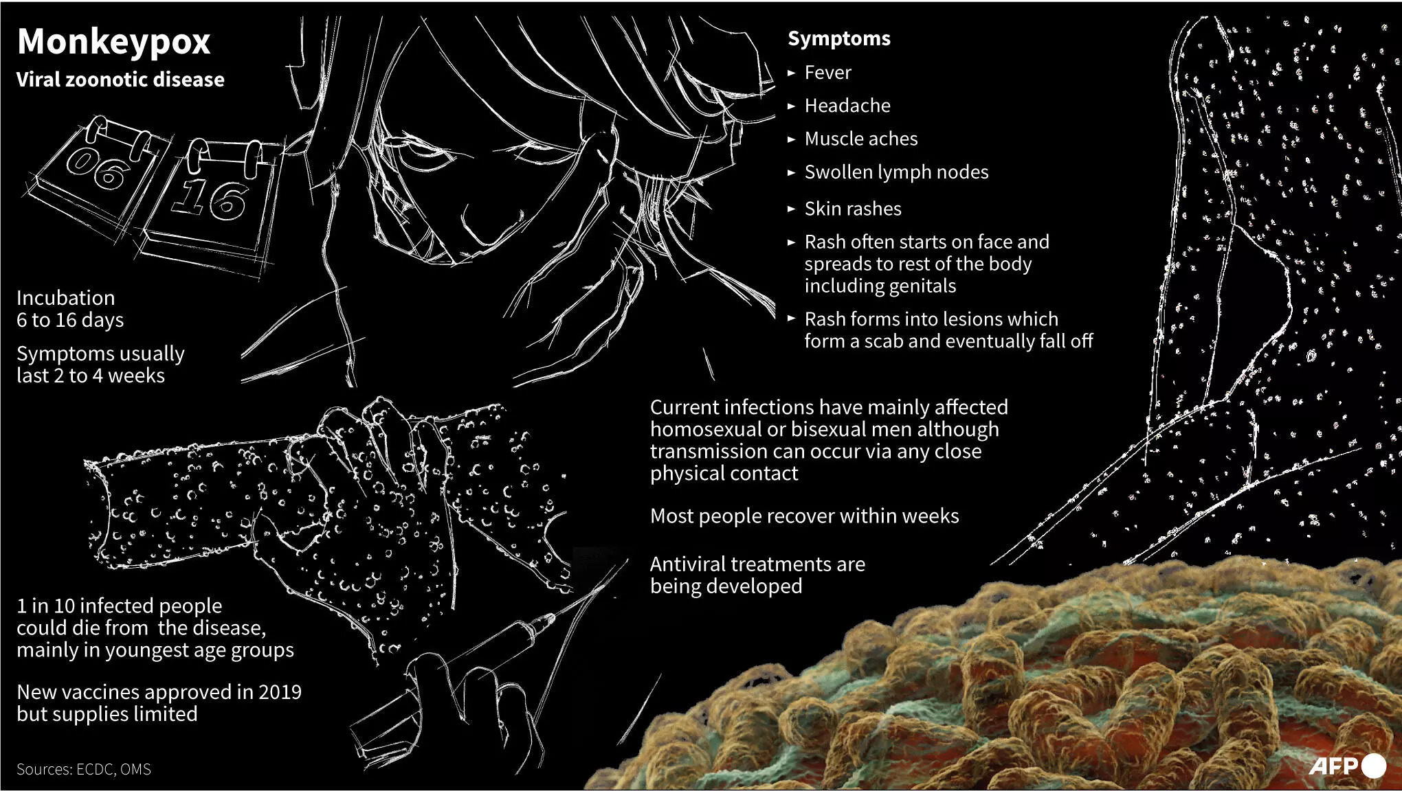 Virus Cacar Monyet Menular Lebih Cepat dari yang Diperkirakan