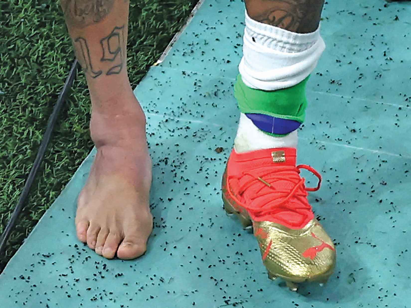 PERGELANGAN KAKI BENGKAK: Pergelangan kaki pemain Brasil Neymar bengkak saat meninggalkan lapangan pada akhir pertandingan sepak bola Grup G