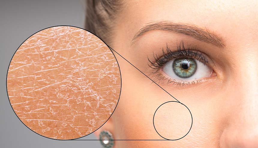 Ilustrasi. Produk yang paling banyak diminati adalah produk yang bisa mengatasi kerusakan skin barrier seperti 'body lotion'.