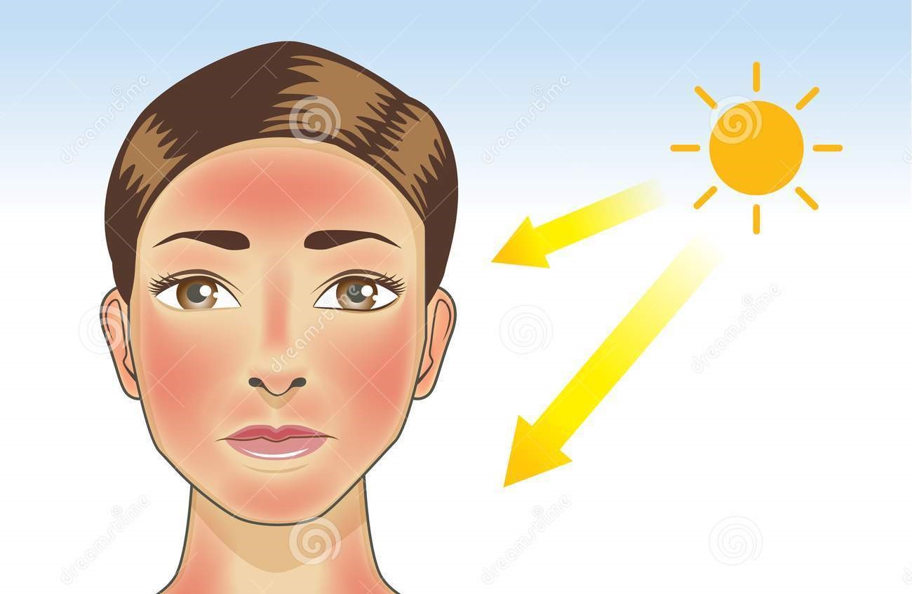 Ilustrasi. Kondisi iklim tropis mempengaruhi kulit penduduk seperti penuaan dini, jerawat, hingga kulit kusam.