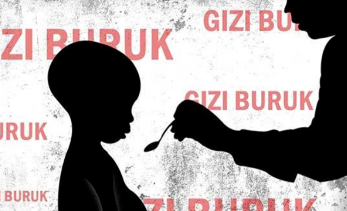 Ilustrasi - Stuting. 