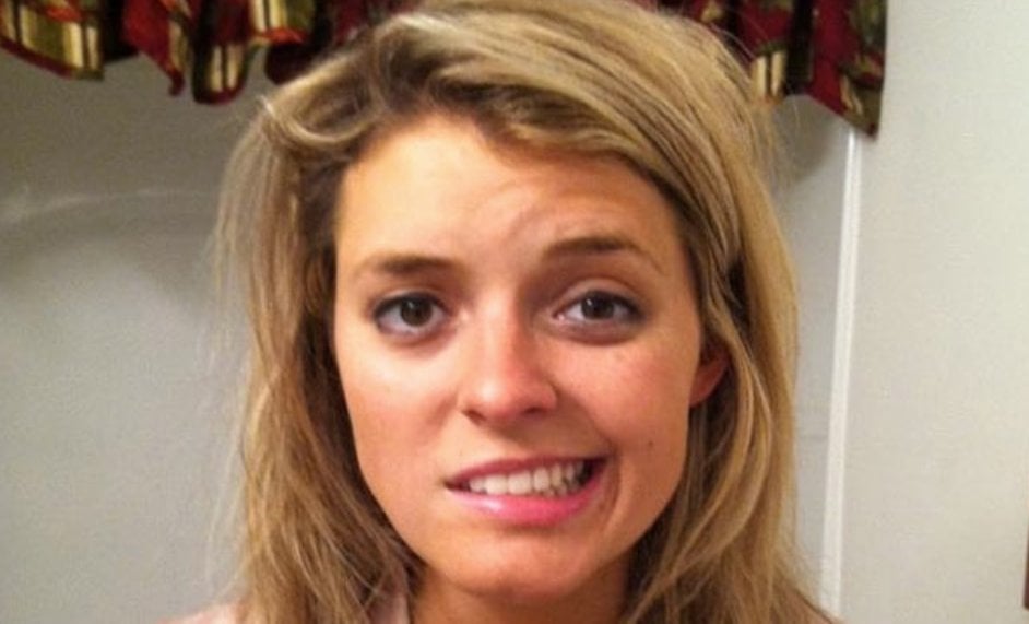 Ilustrasi--pasien Bell's Palsy