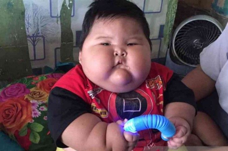 Balita oObesitas Muhammad Kenzi Alfaro asal Kampung Tambun Permata, RT 002/002, Desa Pusaka Rakyat, Kecamatan Tarumajaya, Kabupaten Bekasi.