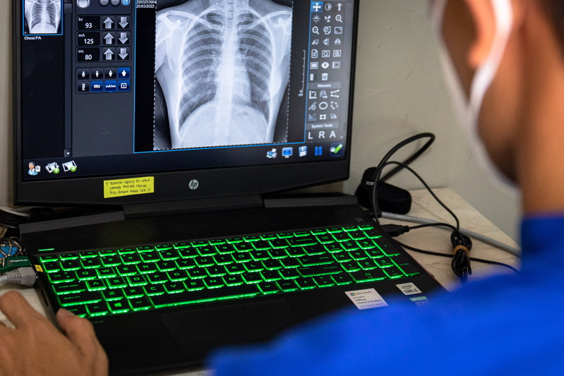 Tenaga kesehatan melihat hasil x-ray untuk mendeteksi TBC