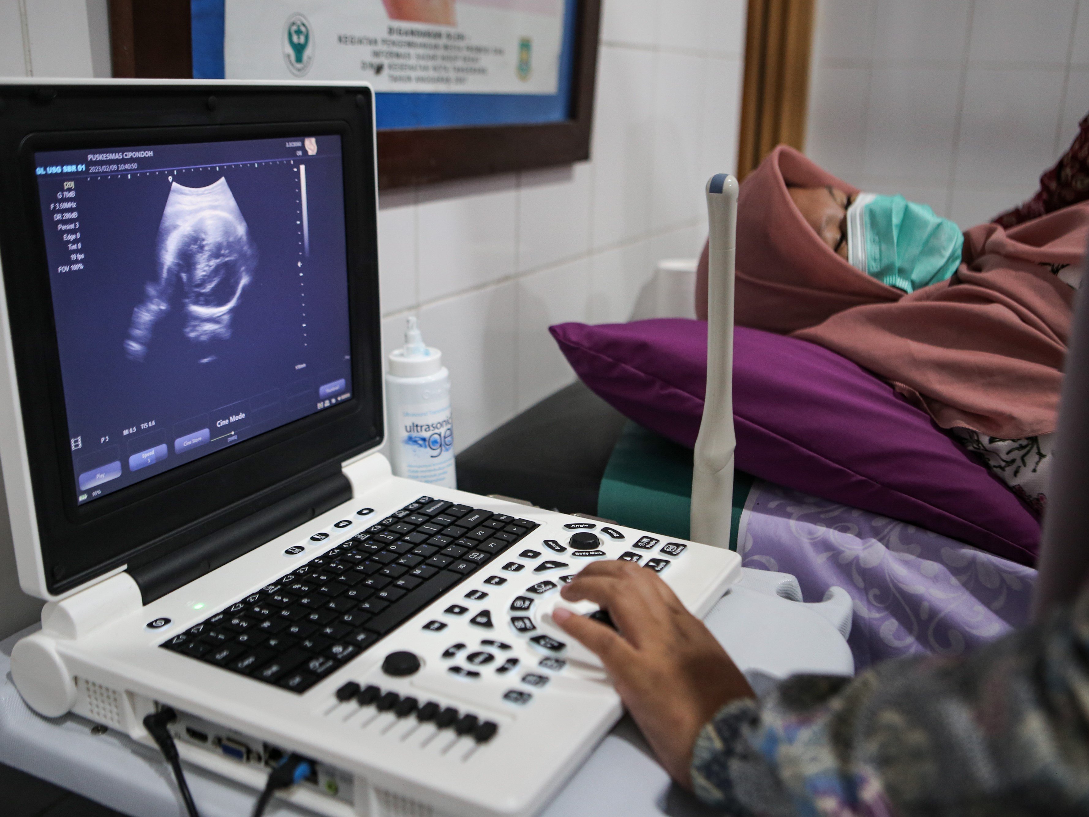 Seorang dokter melakukan pemeriksaan ultrasonografi (USG) kepada ibu hamil di Puskesmas Cipondoh, Kota Tangerang, Banten, Jumat (9/2/2023).