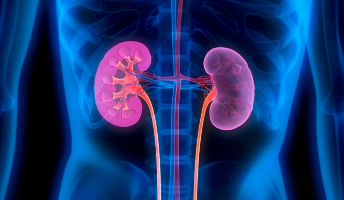 Ilustrasi - Gagal Ginjal.