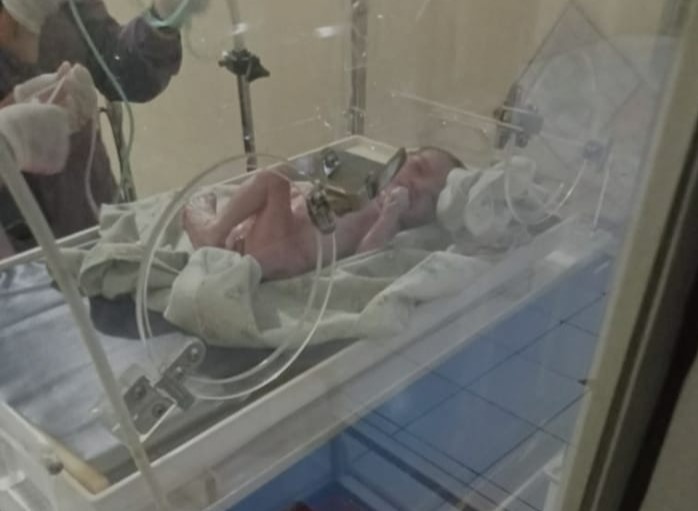 Bayi yang ditemukan di bawah kandang ayam di Kampung Bojong Nangka, Kelurahan Sukamenak, Kecamatan Purbaratu, Kota Tasikmalaya,Jabar.