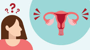 Ilustrasi endometriosis dan masalah kesehatan reproduksi wanita