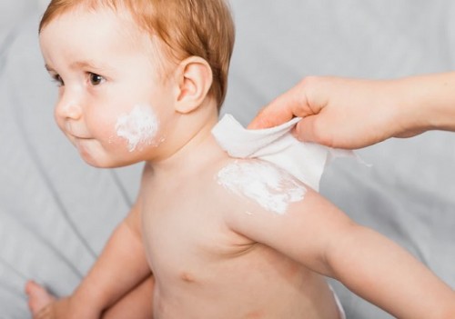 Orangtua Diingatkan Agar Lebih Peduli pada Kesehatan Kulit Bayi