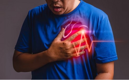 Pola Hidup tidak Sehat Perparah Sumbatan Penyebab Penyakit Jantung Koroner