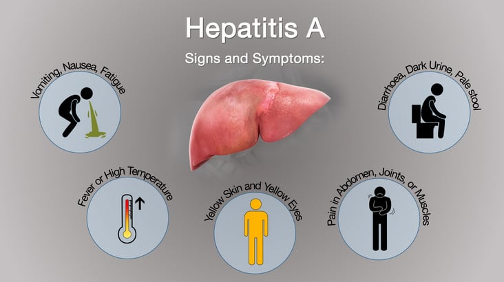 Wie Bekommt Man Hepatitis E Mengenal Penyakit Hepatitis A, Penyebab, Gejala, dan Pencegahannya