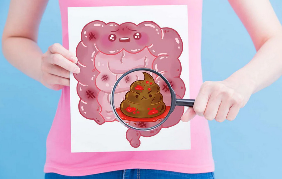 Ilustrasi kesehatan pencernaan dan bakteri usus.