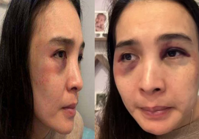 Putri Balqis, korban KDRT Depok yang malah jadi tersangka dan ditahan.