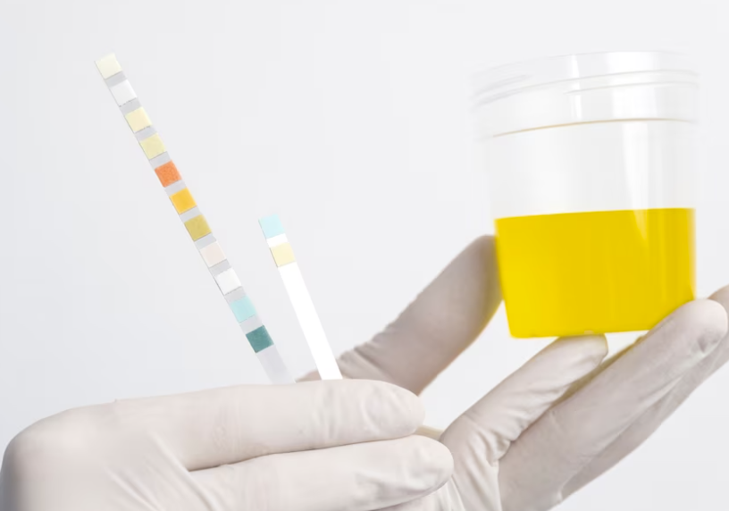 Ilustrasi Test Urine
