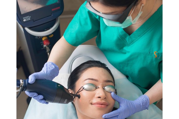 Remajakan Kulit Tanpa Operasi Dengan Perawatan Laser Peeling