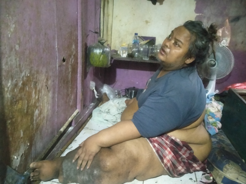Cipto Raharjo, 45, warga Tirtayasa, Pinang, Kota Tangerang mengalami obesitas hingga 200 kilogram. 