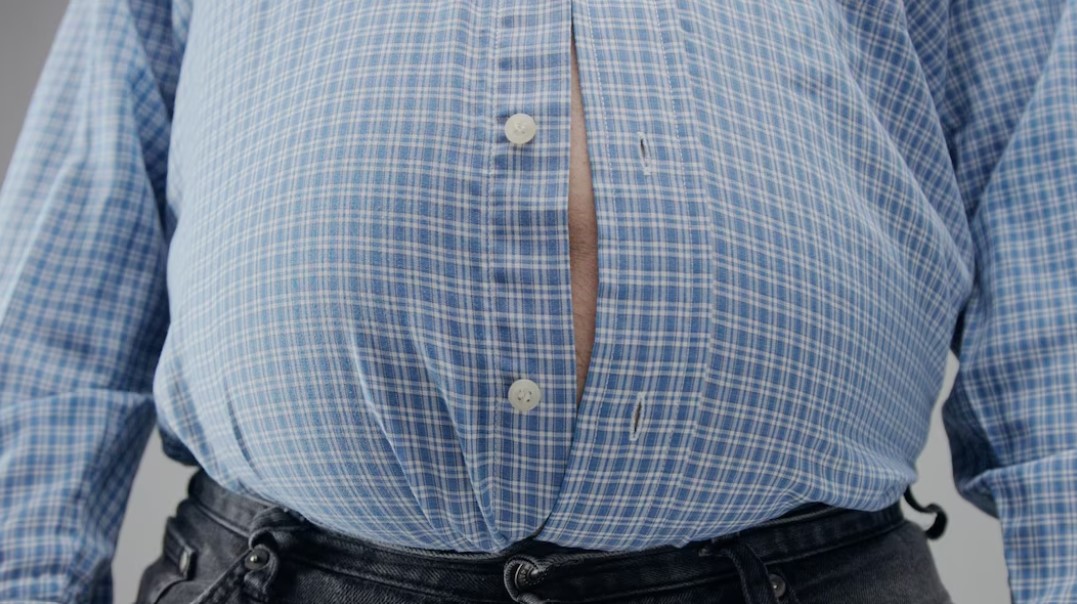 Kegemukan Tingkatkan Risiko Komplikasi Penyakit