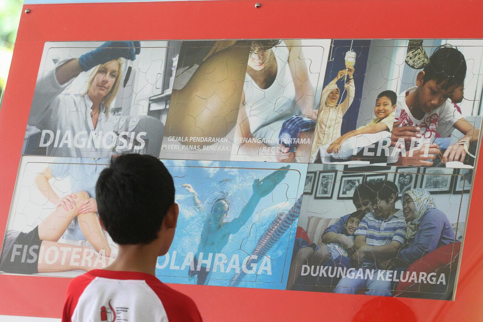 Sejumlah anak penyandang hemofilia mengamati poster sosialisasi hemofilia.