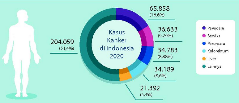 Menkes: Diagnosis Kanker Harus Ikuti Teknologi Terbaru