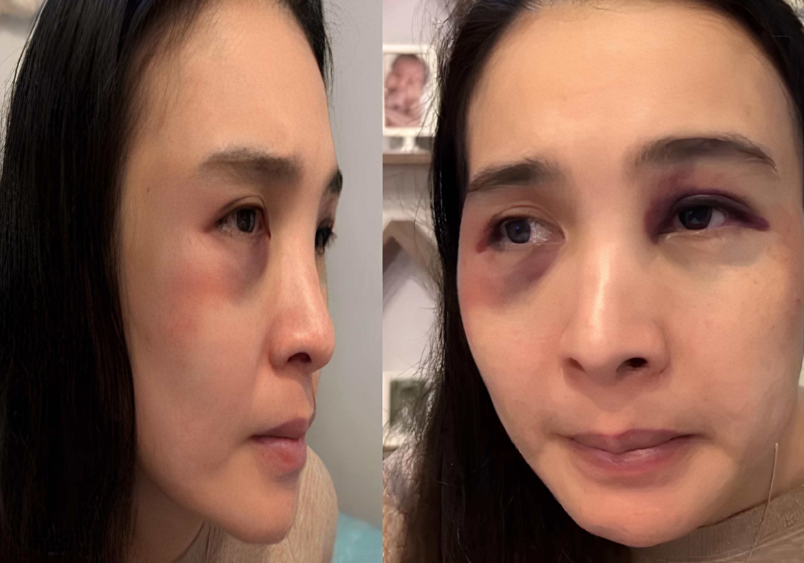 Korban KDRT asal Depok, Putri Balqis.