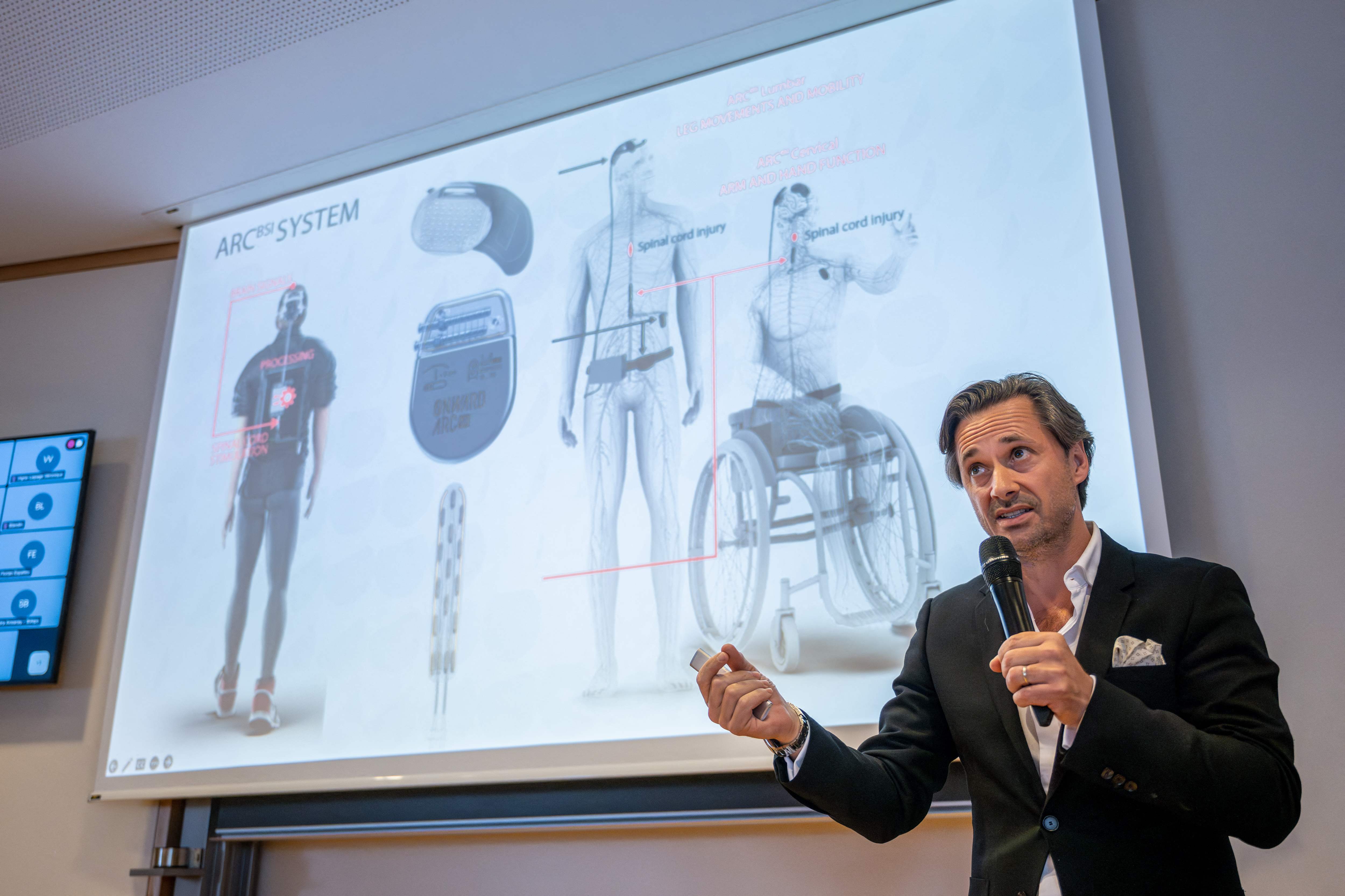 Implan Otak yang Ditopang AI bisa Memulihkan Pergerakan Lengan Pasien yang Lumpuh