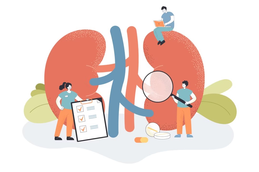 Kista Ginjal Dipastikan Jinak, bukan Kanker