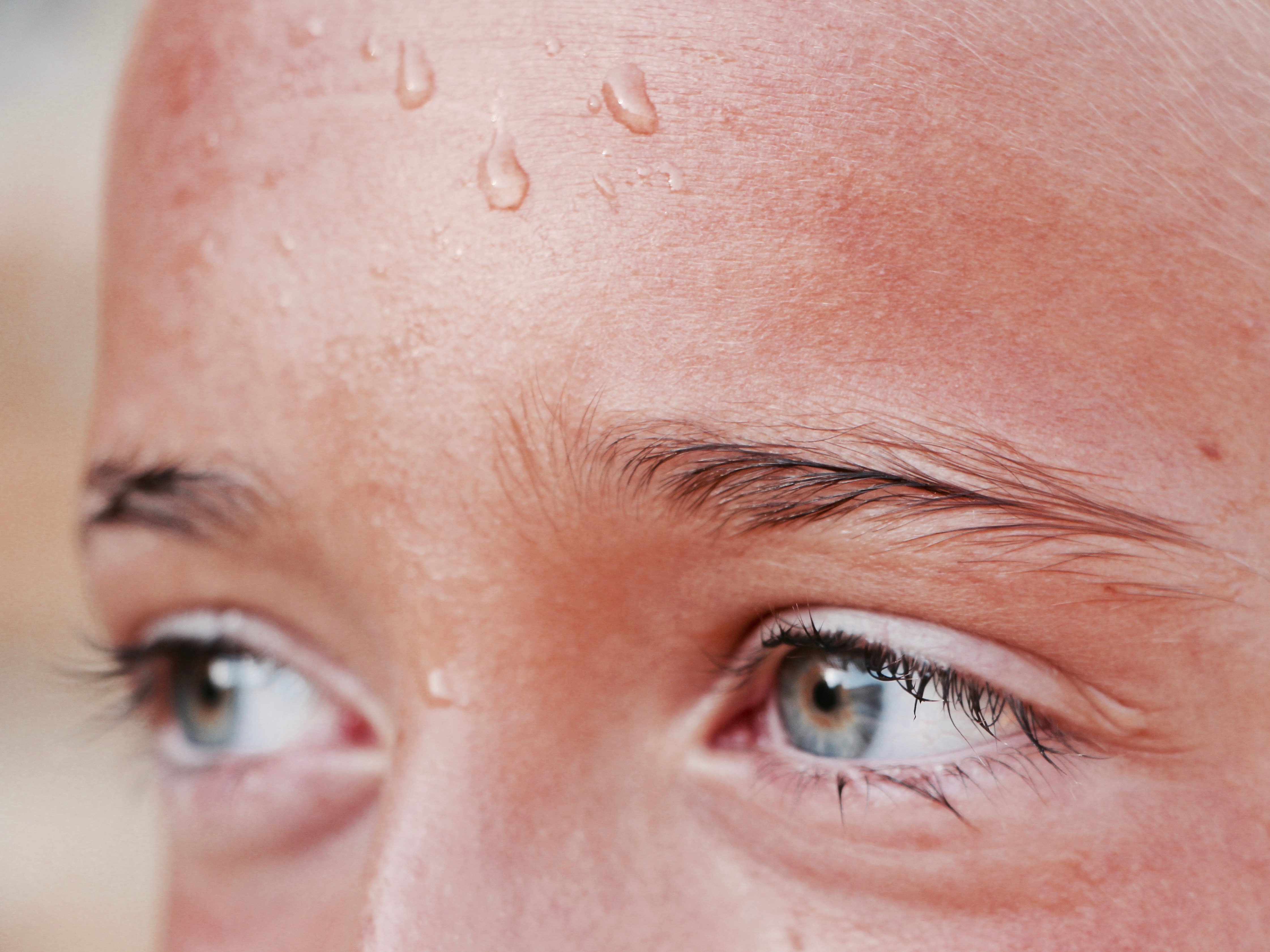 Cuaca panas dapat mendorong timbulnya biang keringat yang bisa membuat aktivitas kita menjadi kurang nyaman.