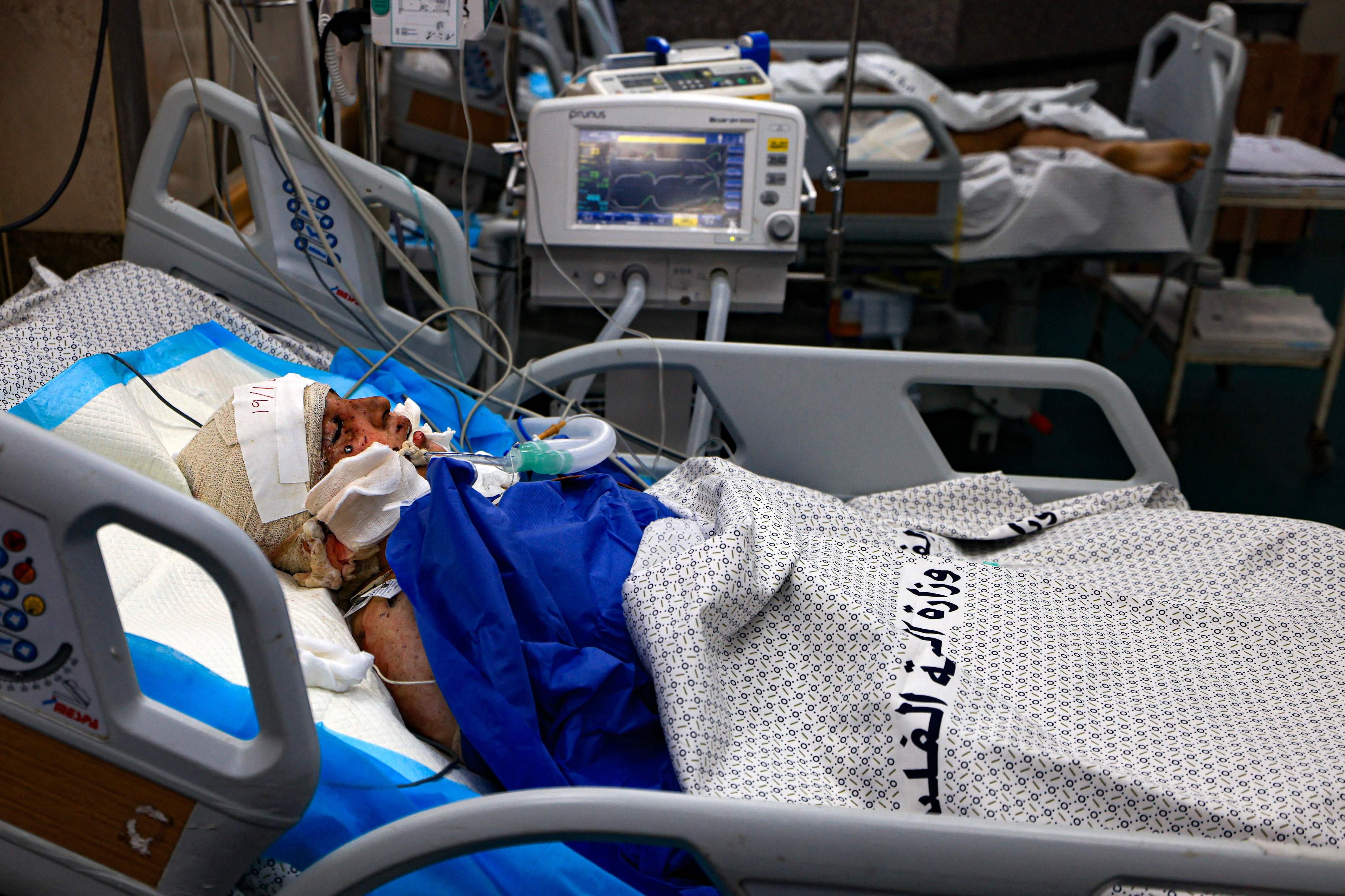 Salah satu anak korban luka bakar bom Israel yang dirawat di Rumah Sakit Nasser, Khan Yunis, Gaza, 21 Oktober 2023.