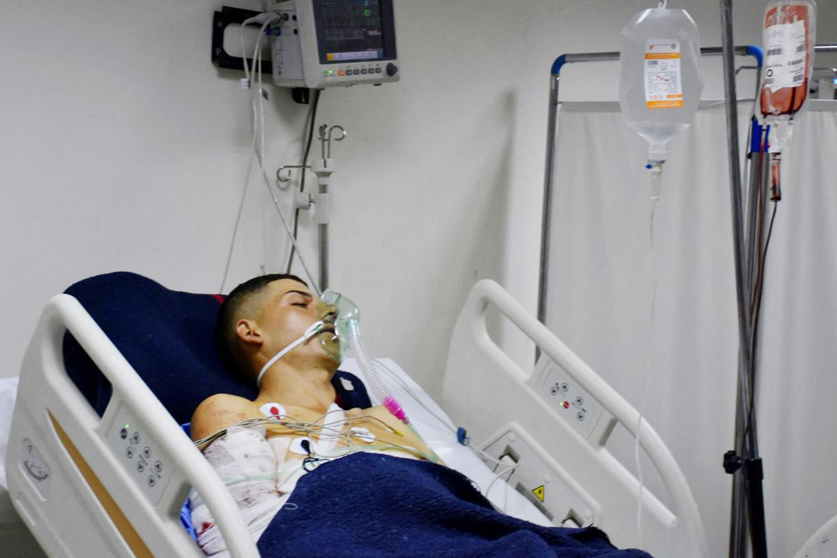 Penduduk Suriah, korban luka akibat serangan pesawat drone do akademi militer Suriah 