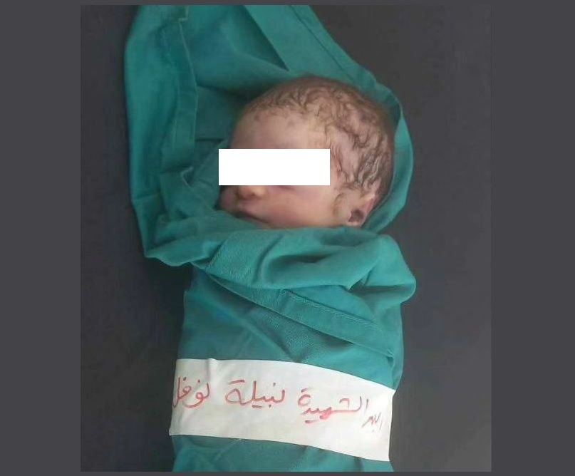 Gaza Hari Ini: Bayi 7 Hari Jadi Korban Syahid Termuda