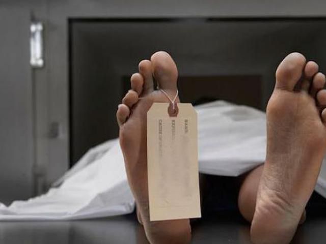 Polisi akan memanggil pelapor atau orang tua korban meninggal dunia akibat mati batang otak setelah menjalani operasi amandel