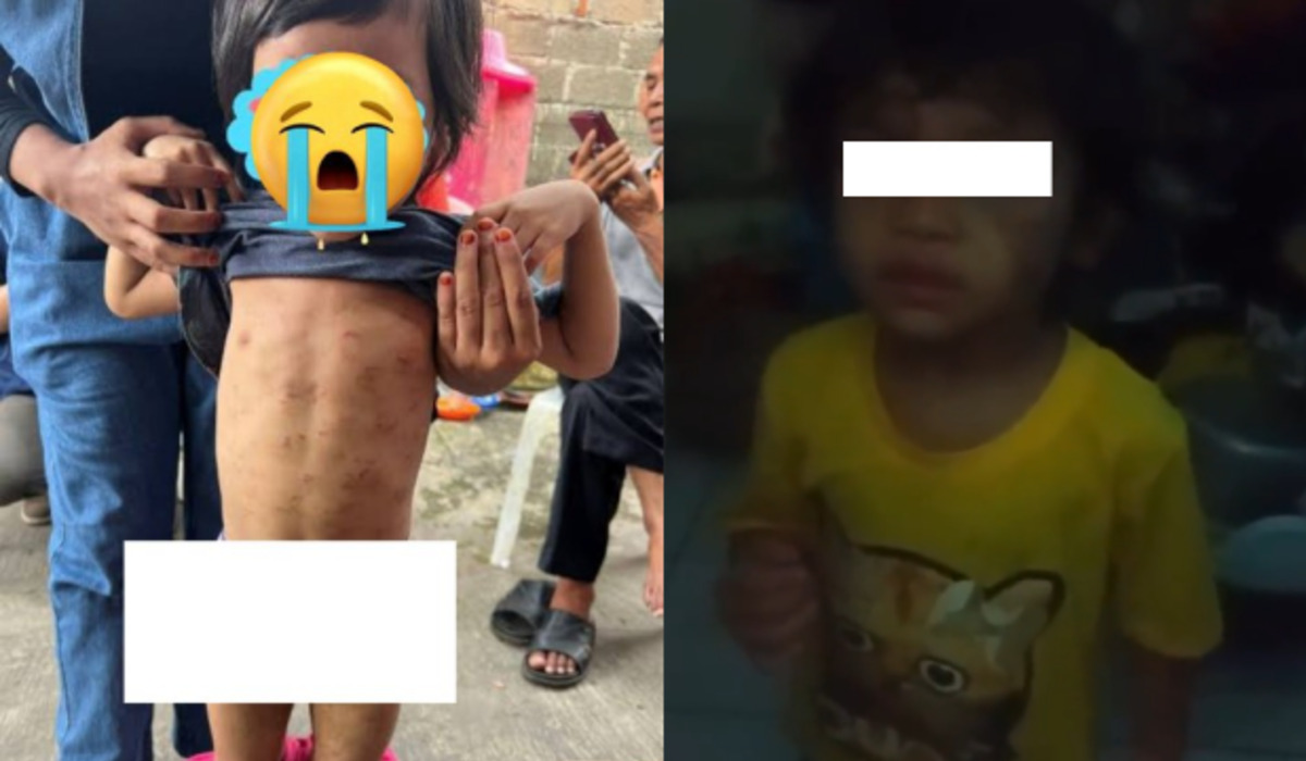 Balita usia 4 tahun di Kota Tangerang yang dianiaya ibu tirinya.