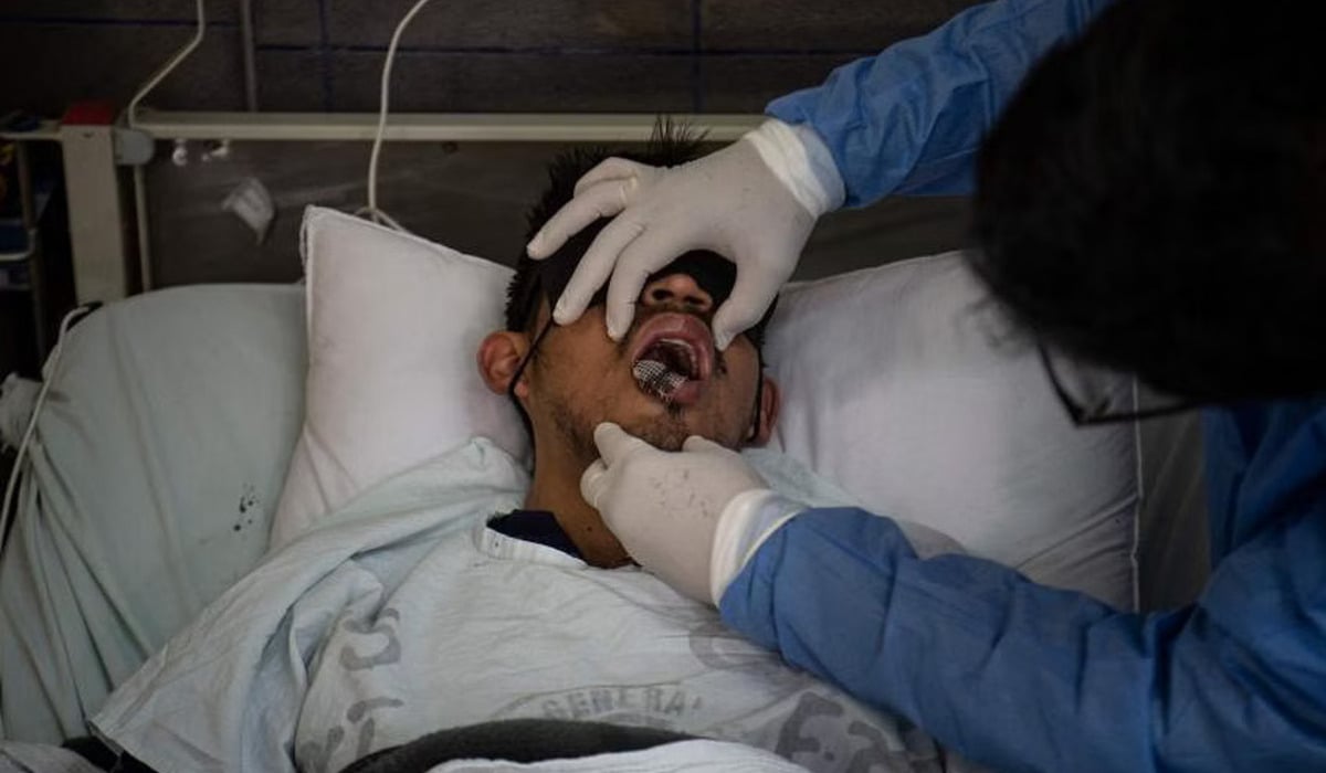 Ilustrasi pasien dengan penyakit cacar monyet atau mpox.