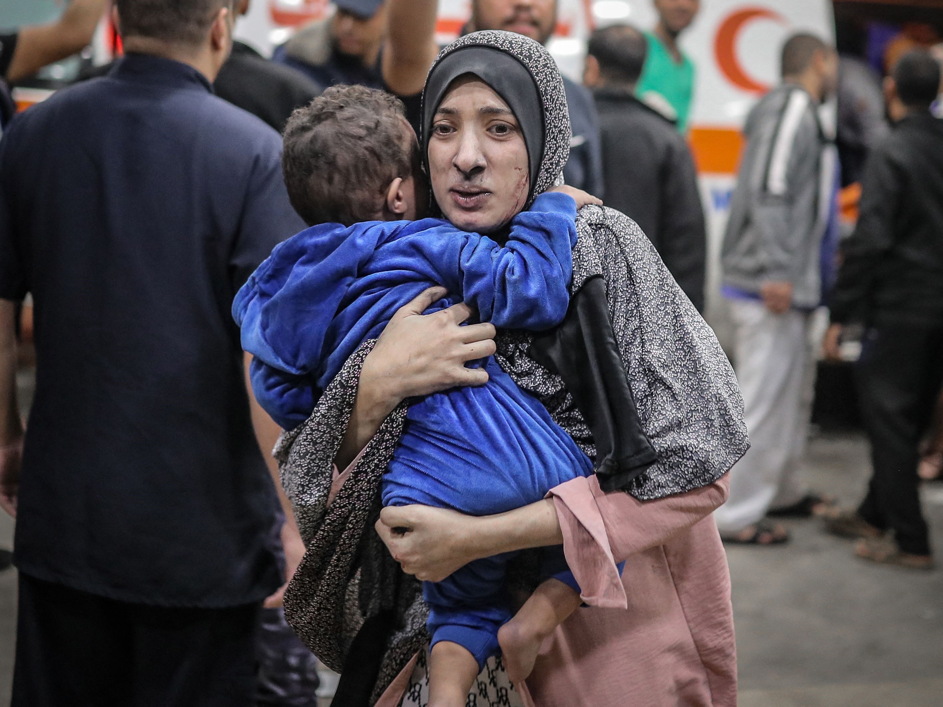 Seorang wanita Palestina berlumuran debu membawa anaknya ke rumah sakit menyusul pengeboman Israel di Khan Yunis, Gaza selatan.