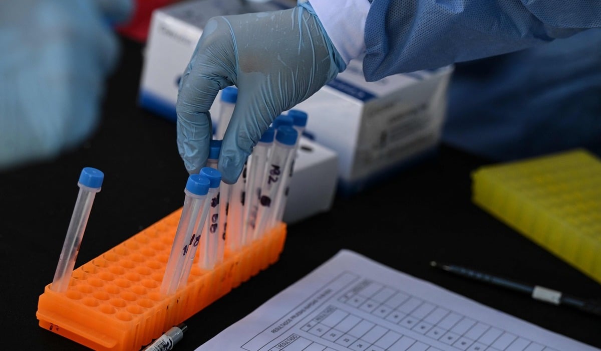 Alat tes swab covid-19.