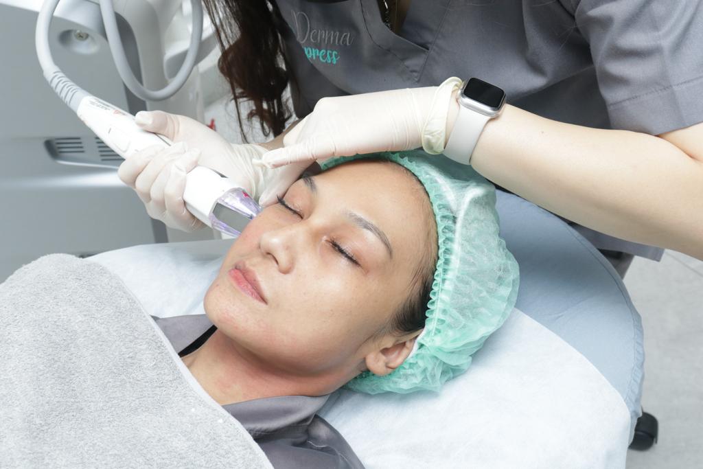 Perawatan RF Virtue Eyes & Face, Neck untuk mengurangi garis atau kerutan halus pada kulit.