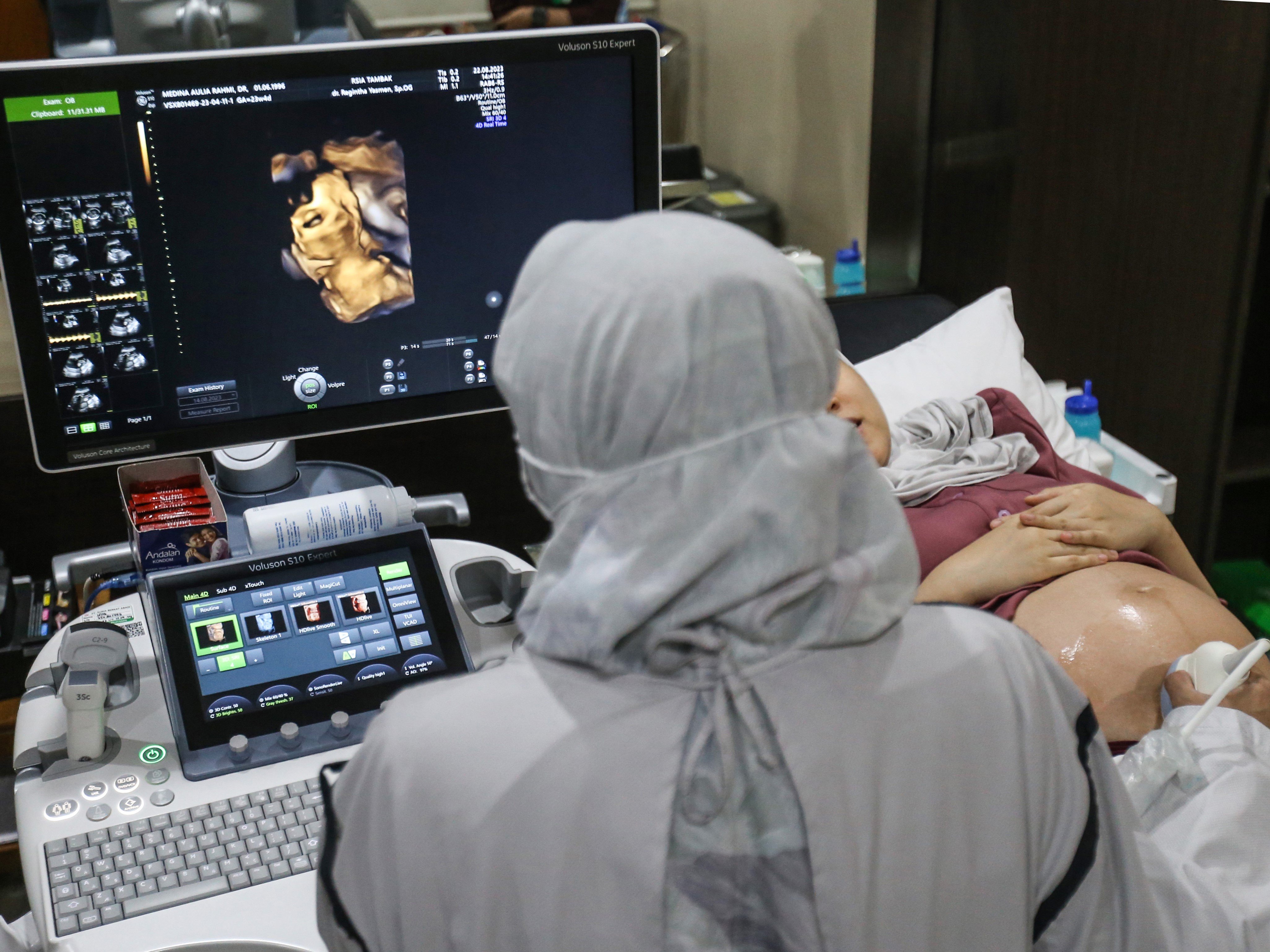 Dokter spesialis kebidanan dan kandungan memeriksa janin ibu hamil dengan peralatan ultrasonografi (USG) di RSIA Tambak, Jakarta.