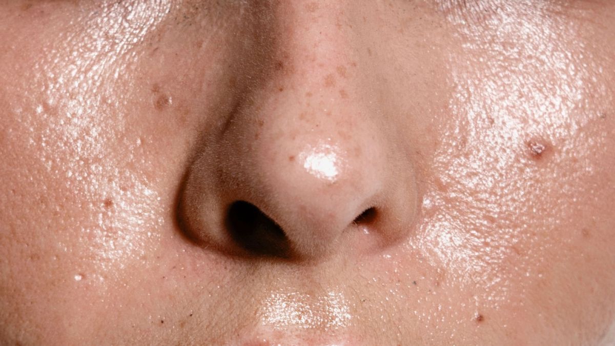 Ilustrasi kulit berminyak