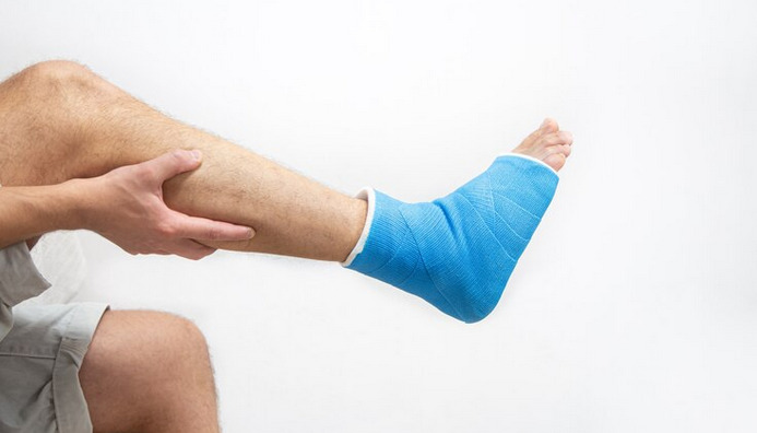 Ilustrasi kaki mengalami keseleo.