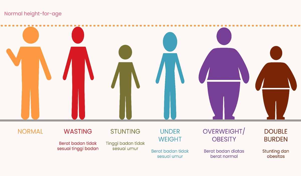 Ilustrasi persoalan gizi pada anak