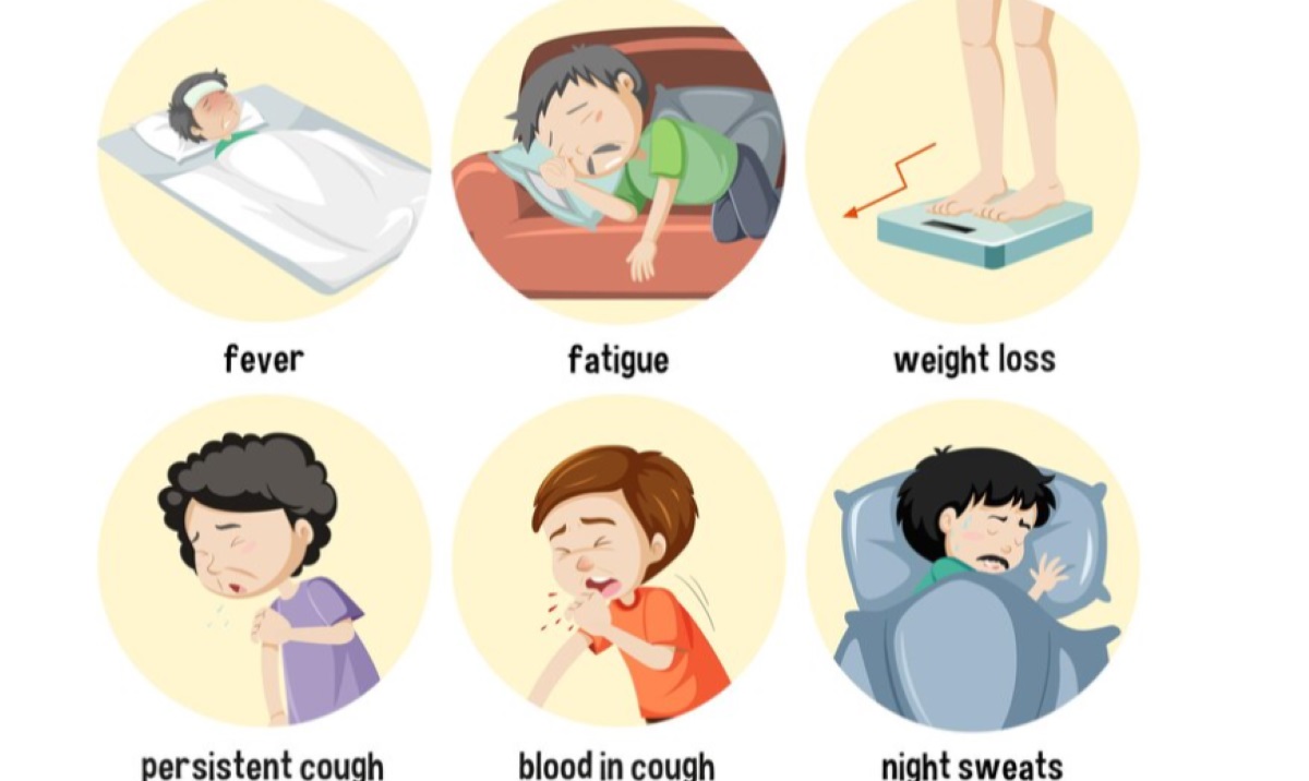 Gejala tuberkulosis.