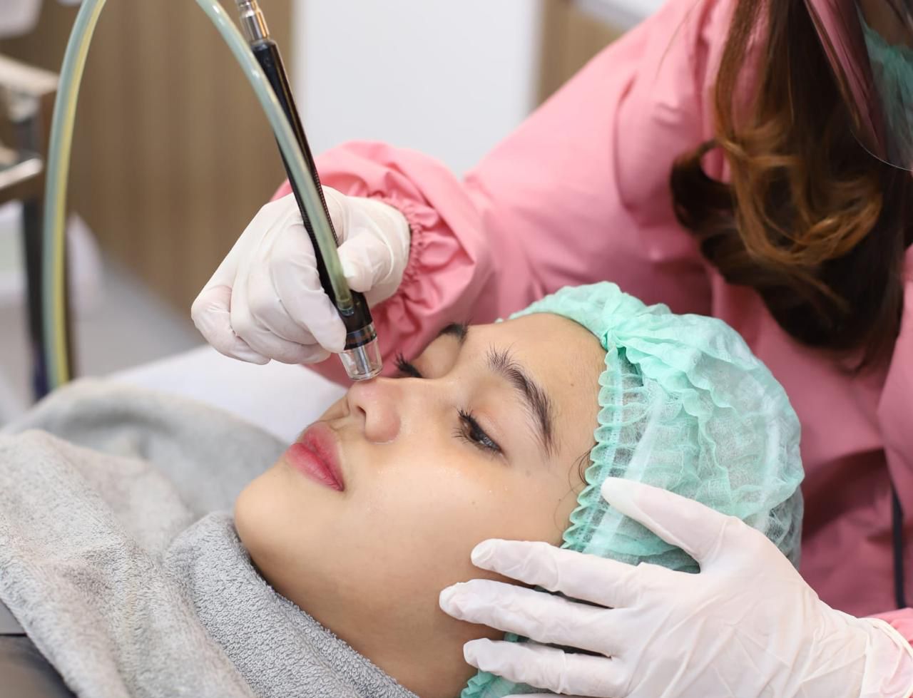 Perawatan oleh dokter estetika membantu mengecilkan pori-pori wajah. 